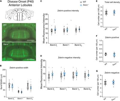 Molecular Identity and Location Influence Purkinje Cell Vulnerability in Autosomal-Recessive Spastic Ataxia of Charlevoix-Saguenay Mice